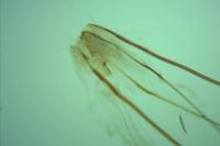 Tinea pellionella