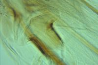 Tinea pellionella