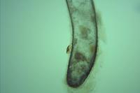 Tinea pellionella