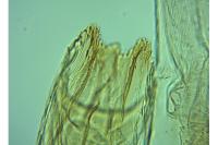 Teleiopsis diffinis