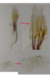 Coleophora albicosta