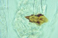Oegoconia deauratella