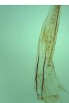 Hypatopa segnella