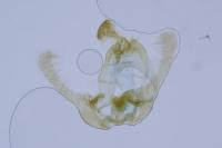Endothenia gentianaeana