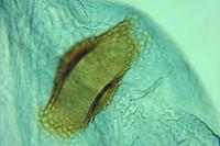 Chionodes electella