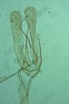 Phyllonorycter maestingella