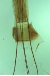 Blastobasis glandulella