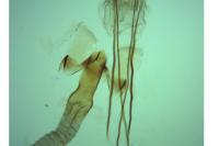 Sorhagenia rhamniella