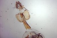 Epinotia nanana