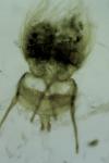 Cnephasia stephensiana