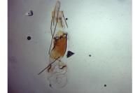 Mompha subbistrigella