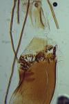 Mompha subbistrigella