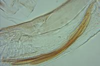 Coleophora alcyonipennella