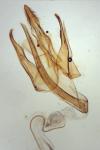 Teleiopsis diffinis
