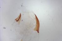 Ancylis mitterbacheriana