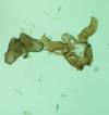 Scythris potentillella