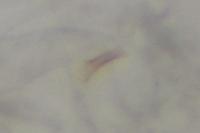 Coleophora