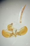 Yponomeuta rorrella