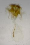 Eana canescana