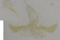 Infurcitinea atrifasciella