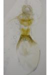 Aethes bilbaensis
