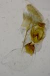 Aethes margarotana