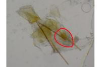 Metzneria hilarella