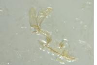 Tinea pellionella