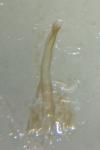 Tinea pellionella
