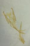 Teleiopsis diffinis
