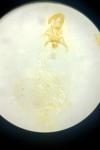 Acleris laterana