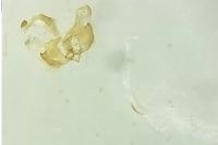 Coleophora alcyonipennella