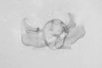 Cochylimorpha straminea