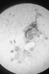 Coleophora