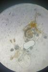 Coleophora