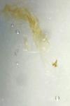 Oegoconia