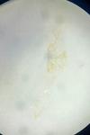 Schiffermuelleria schaefferella