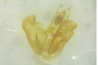 Depressaria radiella