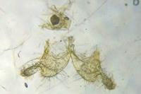 Coleophora deauratella