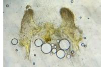 Aethes flagellana