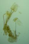 Metzneria artificella