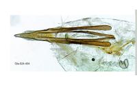 Glaucolepis