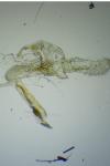 Apatema proteroclina