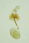 Rhigognostis