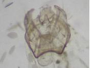 Ectoedemia