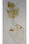 Epinotia immundana