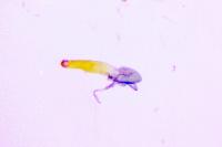 Oxyptilus laetus