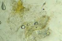 Acleris ferrugana