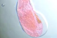 Acleris schalleriana