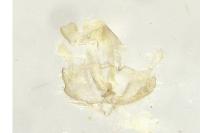 Coleophora